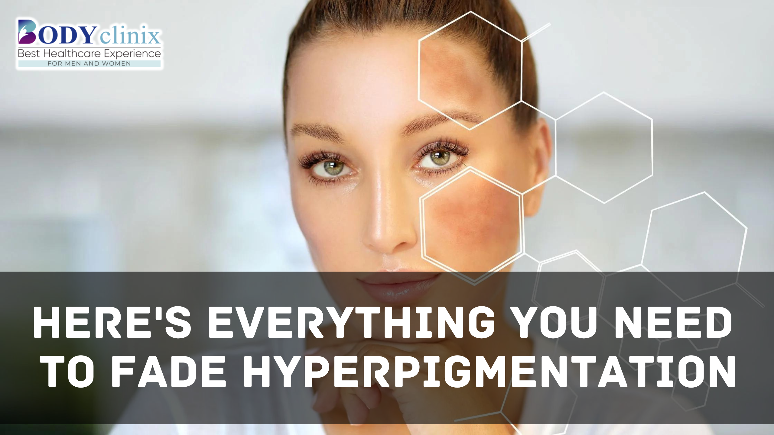 Here's Everything You Need To Fade Hyperpigmentation