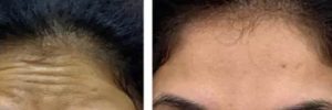 2023-05-13-13_25_12-Best-Botox-Treatment-in-delhi-with-Latest-Prices-_-Top-Botox-specialists-Near-Me-q6e7u5hfbjcl7lvg40qwhuqzku3kurit2t6s93t59k